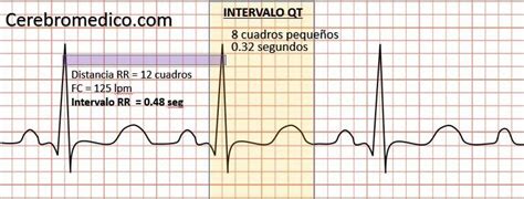 Qt Sinais De Slots Constante De Referencia