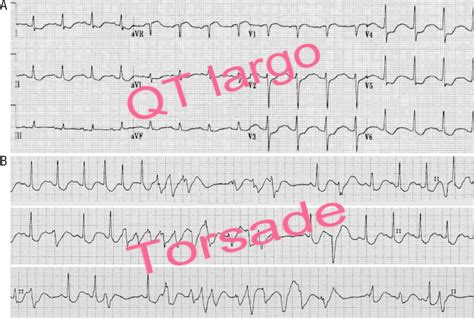 Qt Sinal De Fenda Qimage