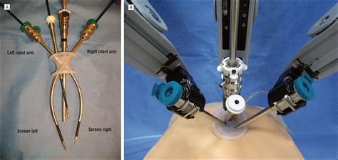 The Da Vinci Device Parimatch